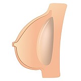 Sanmu doll ボディ単体 リアルドール ラブドール 人気ドール