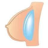 【11月キャンペーン 二つ目ヘッド半額 11月30日まで】BC DOLL フルシリコンドール 高級等身大フィギュア セクシーアニメキャラクタードール